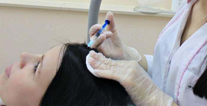 Mezoterapia w celu pozbycia się łupieżu