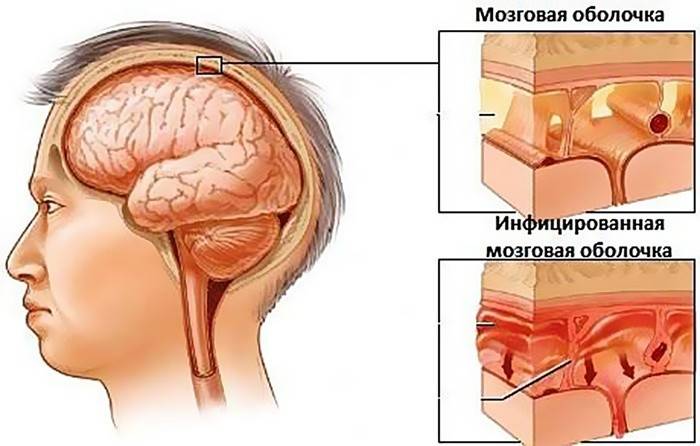 Porovnanie zdravého a chorého mozgu