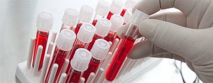 Examen de sangre en el laboratorio.
