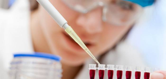 Técnico de laboratorio realiza un análisis de sangre para el colesterol.