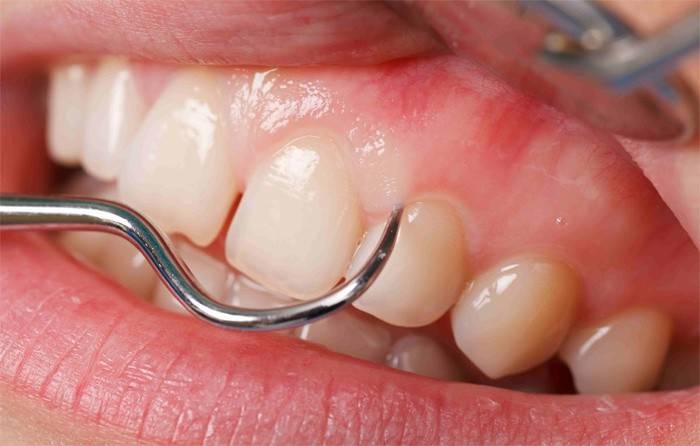 Exame dentário pelo dentista