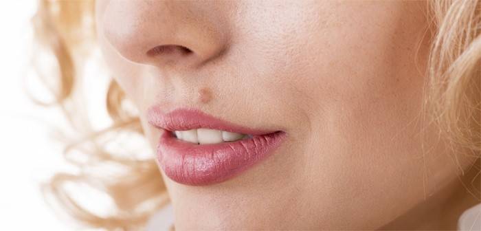 Fibroma en la cara