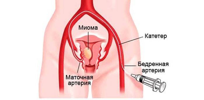 Cirurgia - uma chance de se livrar do tumor
