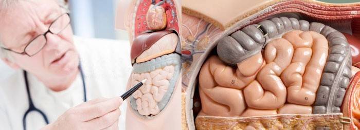 Intussuscepção (inversão) dos intestinos