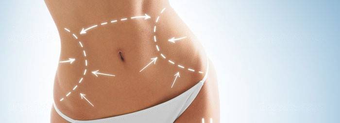 Abdominoplastia para eliminar a diástase