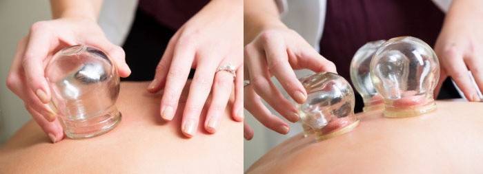 Frascos de masaje para celulitis
