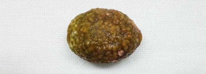 Príklad veľkého kameňa