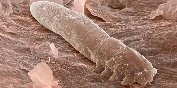 Marque Demodex bajo el microscopio