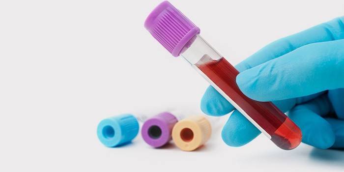 Examen de sangre para sífilis