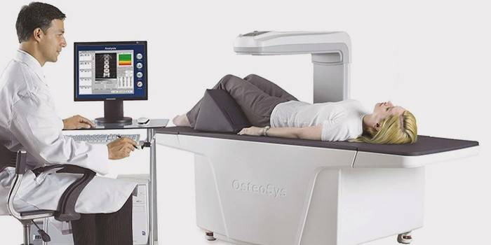 Denzitometria na diagnostiku osteoporózy