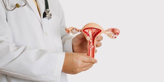 Um médico fala sobre miomas uterinos