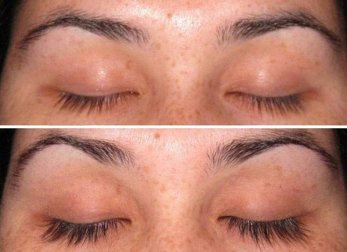 Pestanas antes e depois de usar aevita
