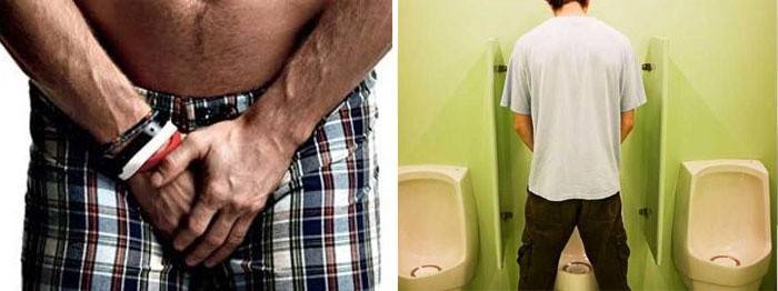 Micción frecuente en hombres