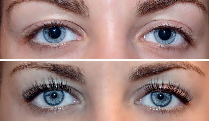 Fotos antes e depois do procedimento