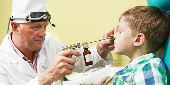Lavado nasal con dioxidina