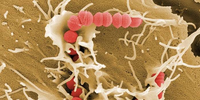 Baktérie Streptococcus