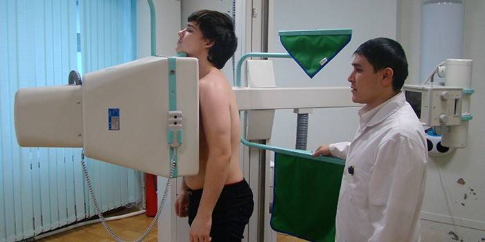 Prevenção de Tuberculose Pulmonar em Adultos - Fluorografia