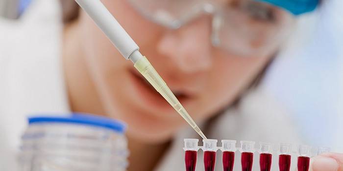 Laboratórny asistent skúma krv