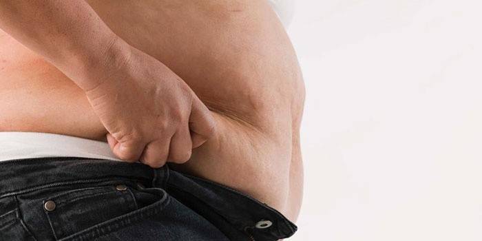 Celulitis masculina