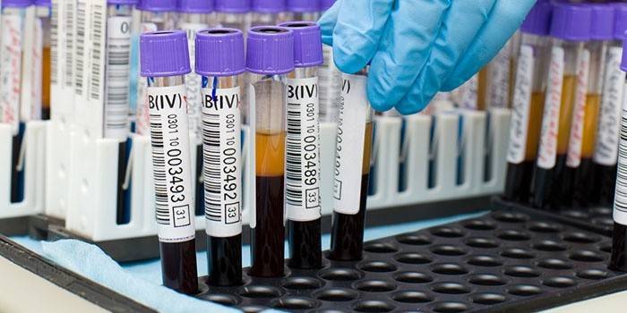 Laboratórny technik vyberie skúmavku