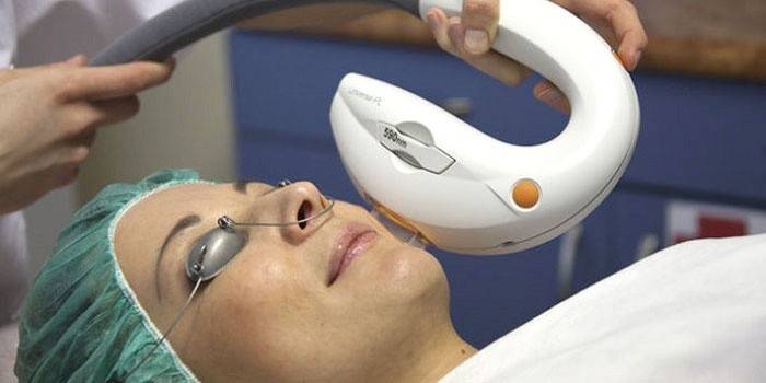 Fototerapia para manchas da idade
