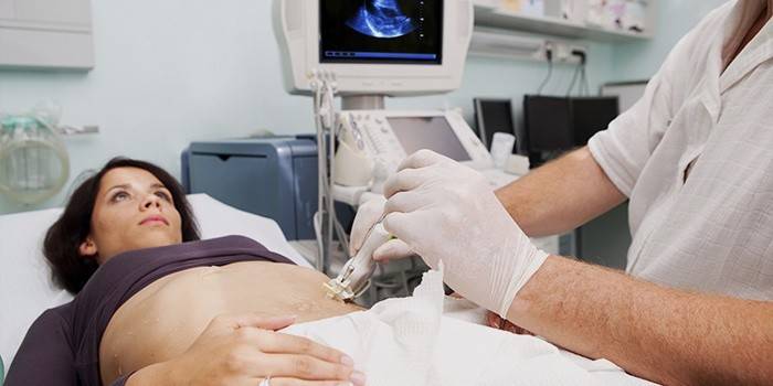 Kobieta przechodzi badanie ultrasonograficzne narządów jamy brzusznej