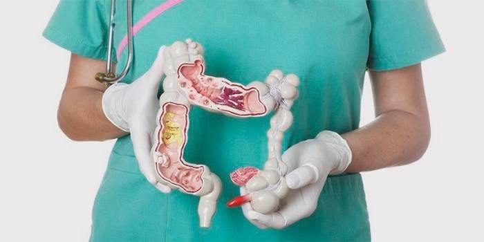 O médico mostra os intestinos no contexto