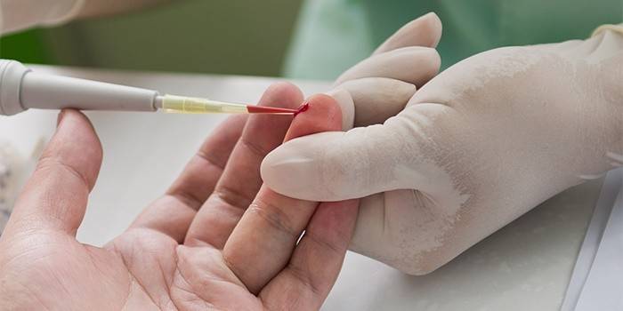 Laboratórna analýza