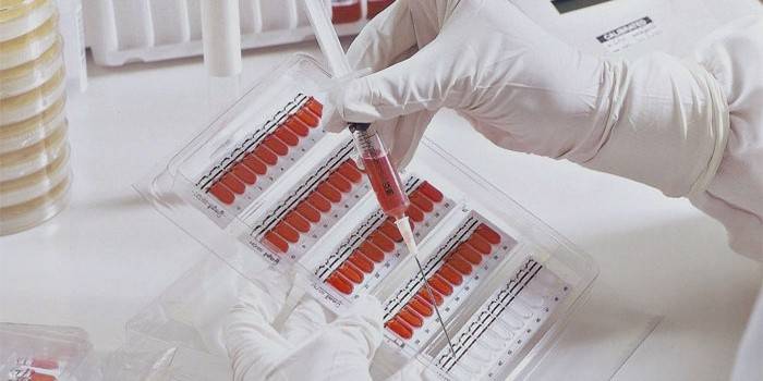 Laboratórny technik drží striekačku
