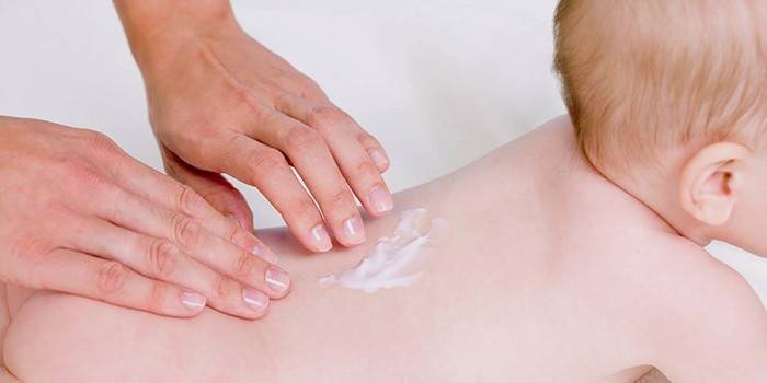 Tratamento da dermatite de contato em uma criança