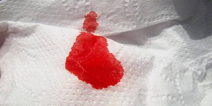 Sangue escarlate do ânus no papel higiênico