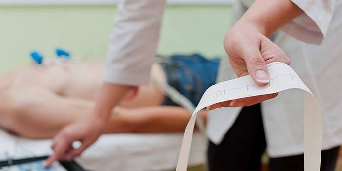 Metoda diagnostyczna - elektrokardiogram