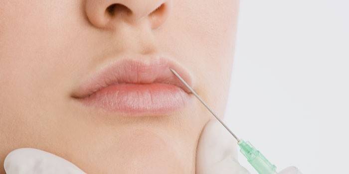 Labio lipofilling