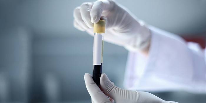 Sangue in vitro para análise.