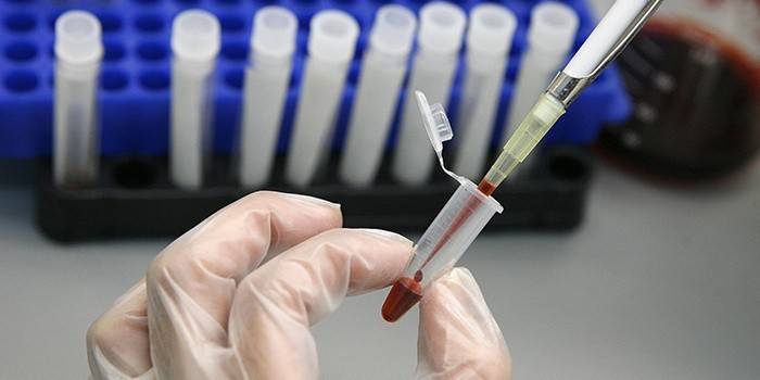 Laboratórny asistent skúma krvné testy