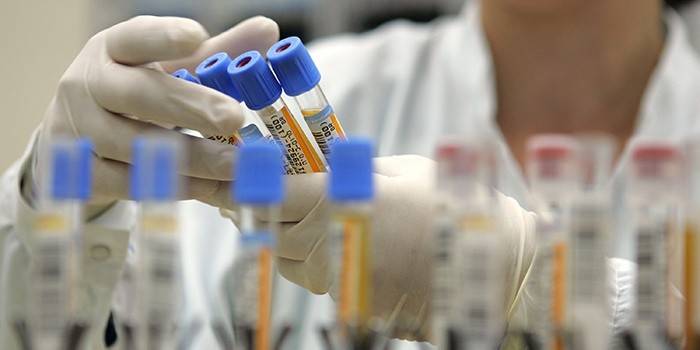 Diagnostika HIV