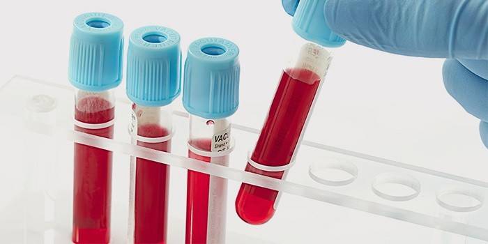 Laboratórny technik vyberie skúmavku