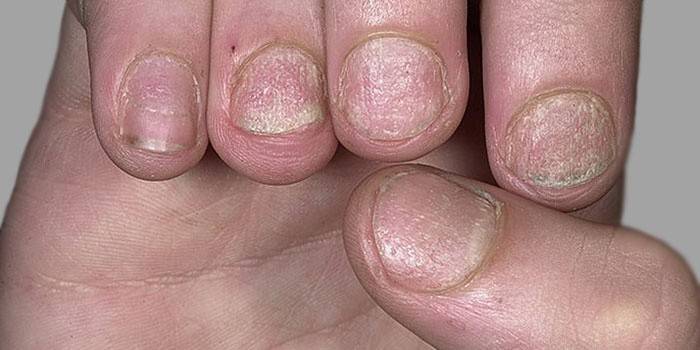 Tipos comuns de doença