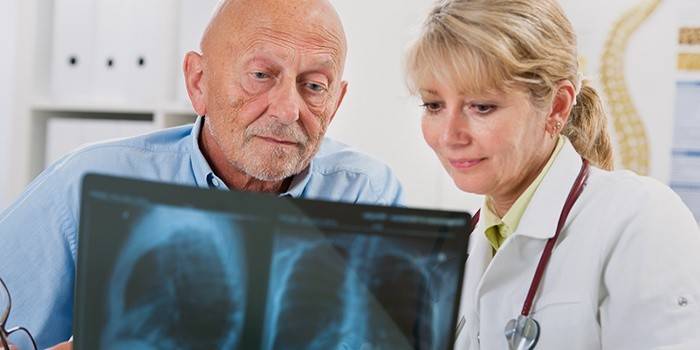 Médico y paciente observando una radiografía de los pulmones.