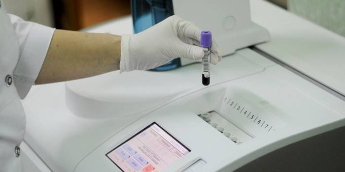 Analiza PCR w celu wykrycia ureplasmosis