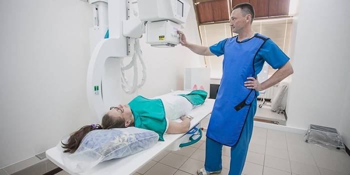 Hysteroalpingoskopia na diagnostiku prolapsu maternice