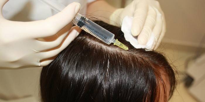 Mesoterapia para cabello