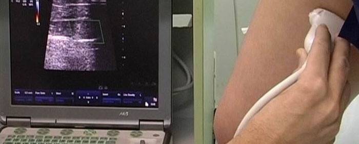 Rozpoznanie miażdżycy naczyń nóg