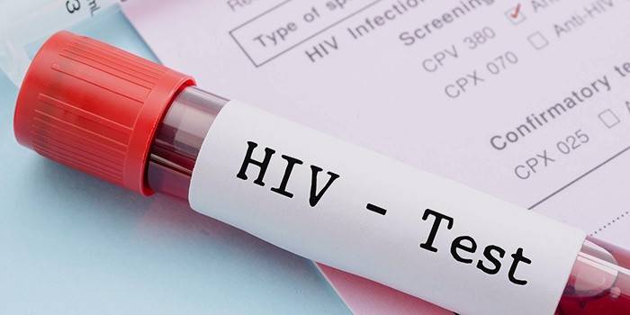 HIV test