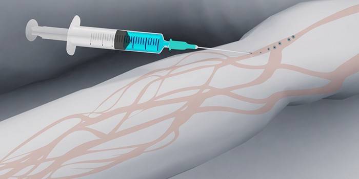 Administração intravenosa de meio de contraste para ressonância magnética