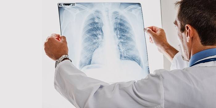 Médico, examina, um, raio x