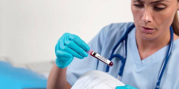Laboratórny asistent skúma krvné testy
