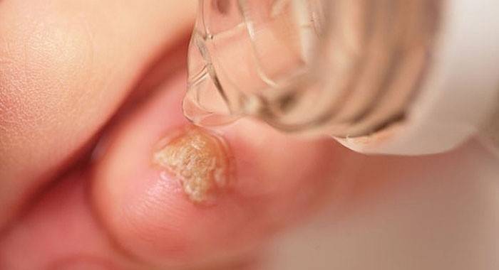 Cremes e pomadas antifúngicas