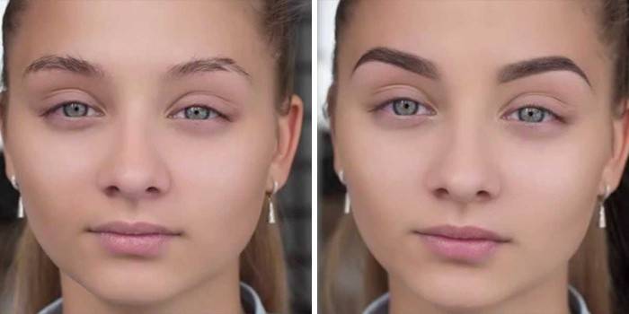 Garota antes e depois de arrancar