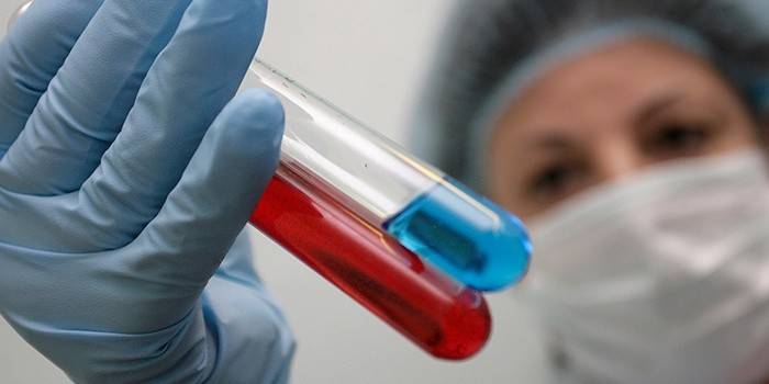Krvný test na HIV